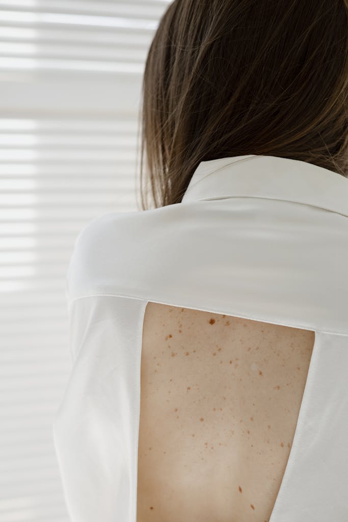 Close-up of a woman's back with freckles, wearing a white shirt indoors.
